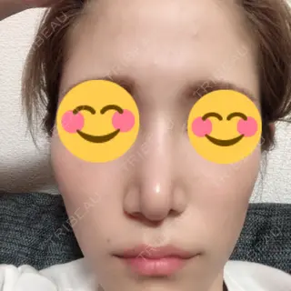 1日目の経過画像（2枚目）