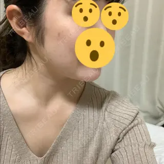 2日目の経過画像（2枚目）