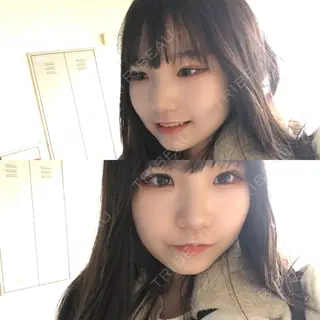 5日目の経過画像（1枚目）