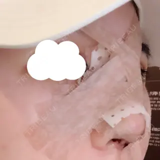 2日目の経過画像（2枚目）