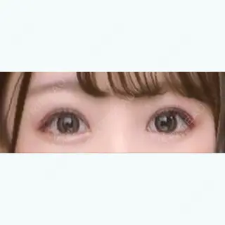 36日目の経過画像（1枚目）