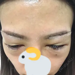 1日目の経過画像（2枚目）