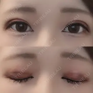 6日目の経過画像（1枚目）