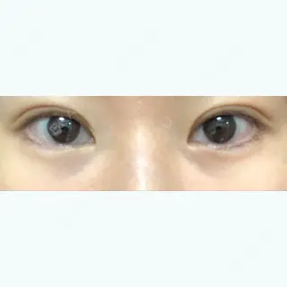 21日目の経過画像（1枚目）
