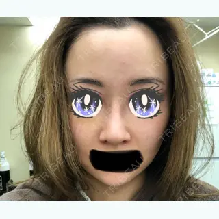 12日目の経過画像（2枚目）