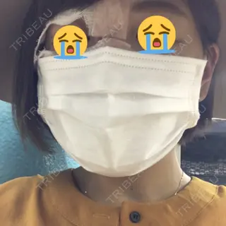 47日目の経過画像（2枚目）