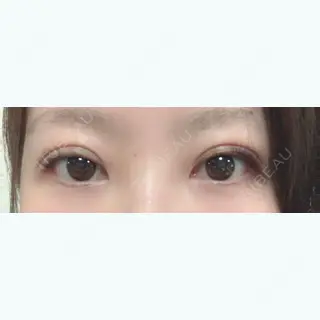 1日目の経過画像（1枚目）
