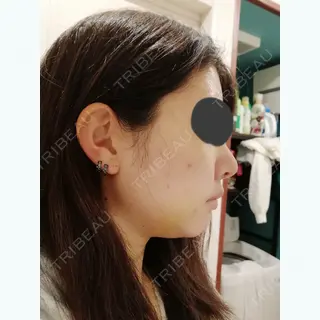 7日目の経過画像（2枚目）