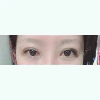 3日目の経過画像（1枚目）