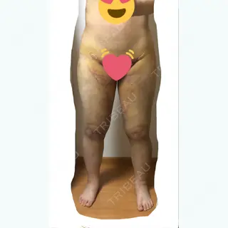 5日目の経過画像（2枚目）