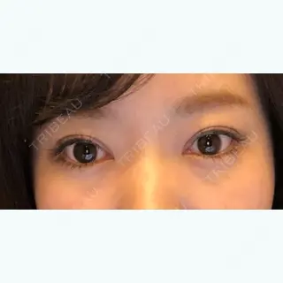 88日目の経過画像（1枚目）