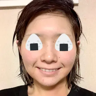 1日目の経過画像（1枚目）