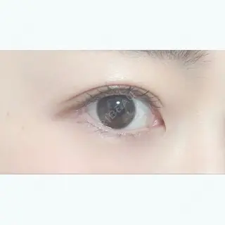 223日目の経過画像（1枚目）