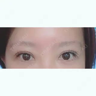 4日目の経過画像（1枚目）