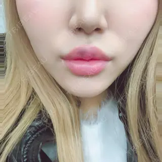 2日目の経過画像（1枚目）