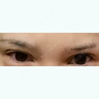 370日目の経過画像（1枚目）