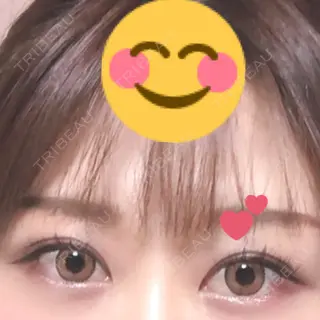 57日目の経過画像（2枚目）