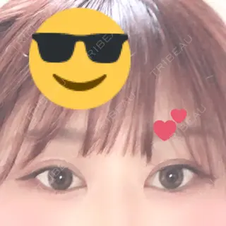 20日目の経過画像（1枚目）