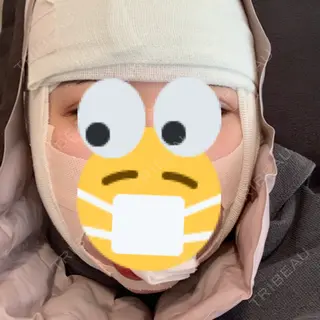 0日目の経過画像（1枚目）