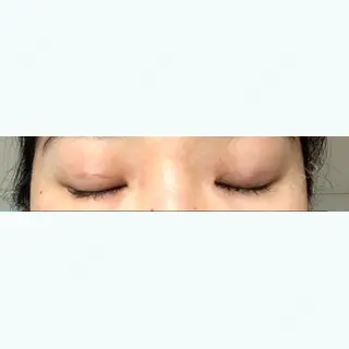 19日目の経過画像（1枚目）