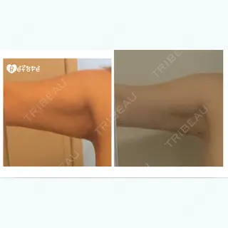 320日目の経過画像（1枚目）
