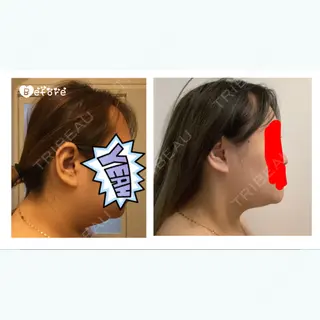 320日目の経過画像（1枚目）