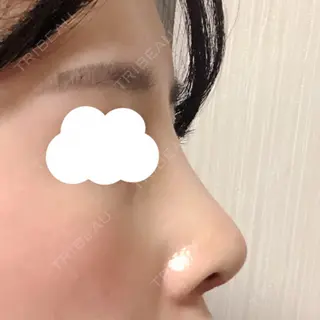8日目の経過画像（3枚目）