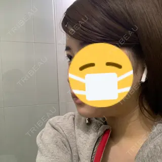 6日目の経過画像（3枚目）