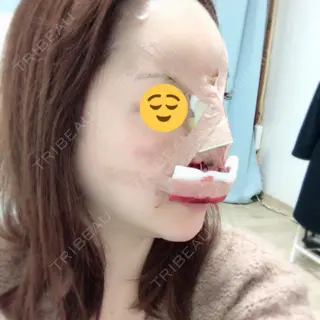 0日目の経過画像（1枚目）