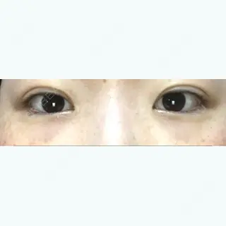 8日目の経過画像（1枚目）