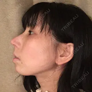 91日目の経過画像（2枚目）