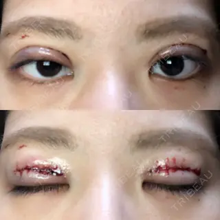 0日目の経過画像（1枚目）