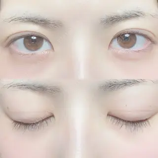 82日目の経過画像（1枚目）