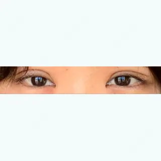 10日目の経過画像（1枚目）