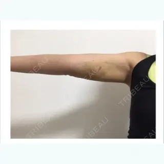 5日目の経過画像（1枚目）