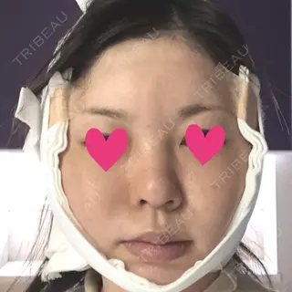 1日目の経過画像（1枚目）