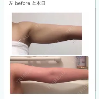 14日目の経過画像（1枚目）