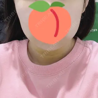 6日目の経過画像（1枚目）
