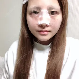 6日目の経過画像（1枚目）
