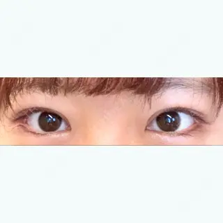 105日目の経過画像（1枚目）