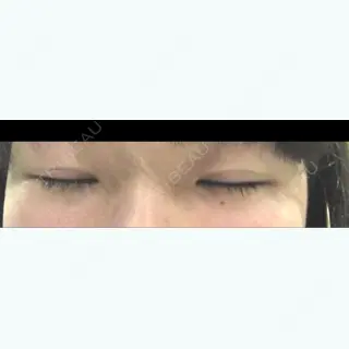 0日目の経過画像（2枚目）