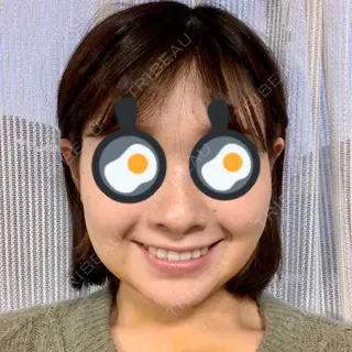 8日目の経過画像（1枚目）