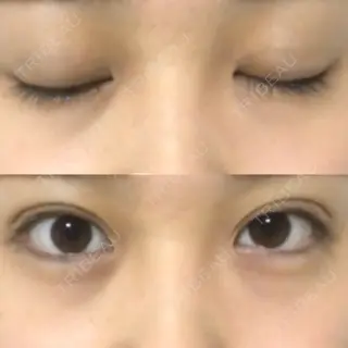 1日目の経過画像（1枚目）