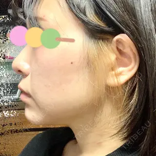 9日目の経過画像（2枚目）
