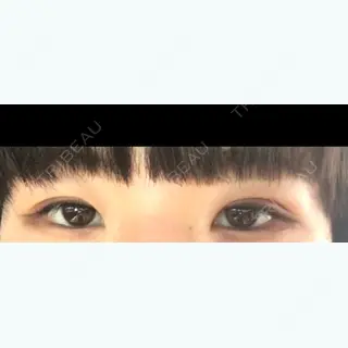 4日目の経過画像（1枚目）