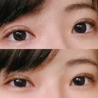 7日目の経過画像（1枚目）