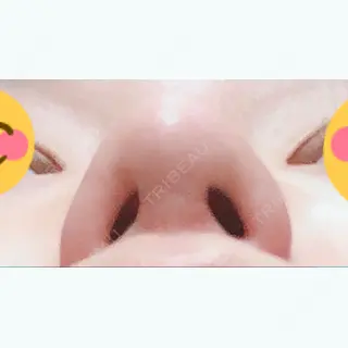 289日目の経過画像（2枚目）