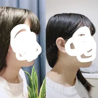9日目の経過画像（1枚目）