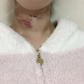 1日目の経過画像（3枚目）