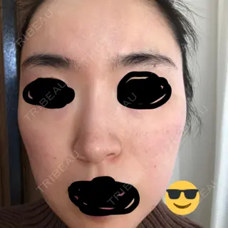 7日目の経過画像（1枚目）